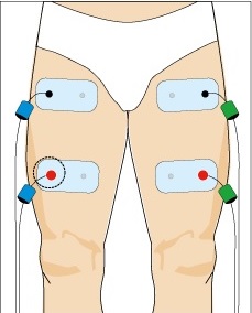 Placement electrode compex cuisse quadriceps