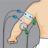 Placement electrode compex bras et triceps